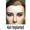 Hair Transplant