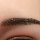 Eyebrow Hair Transplant